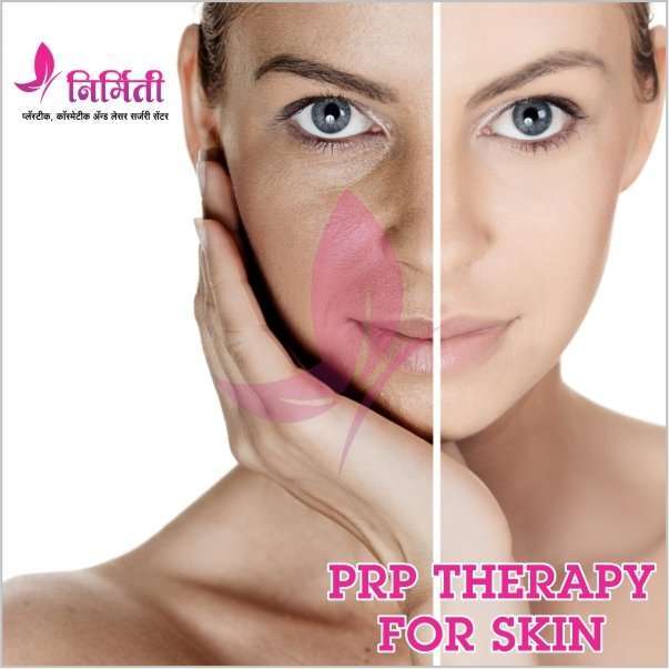 PRP-therapy-for-skin