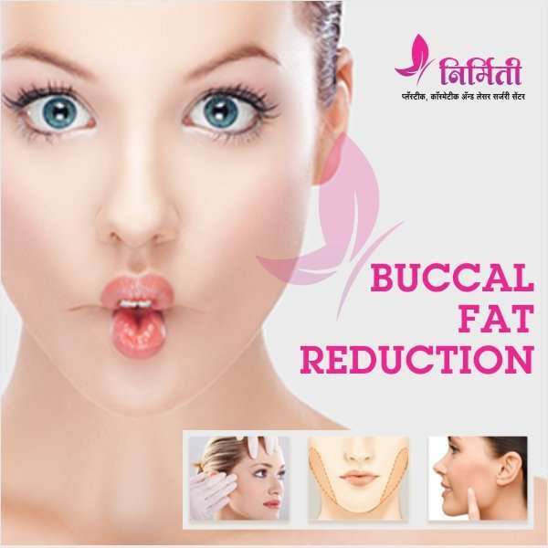 buccal-fat-reduction