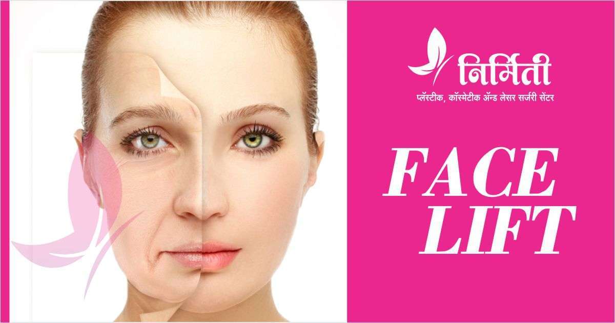 face-lift-surgery-face-lifting-treatment-face-lift-cost