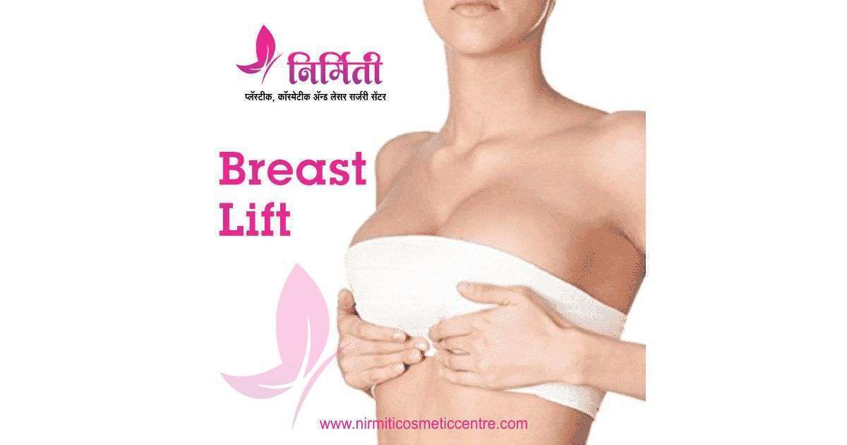 Breast Lift (Mastopexy)- An Effective Treatment for Breast Sagging