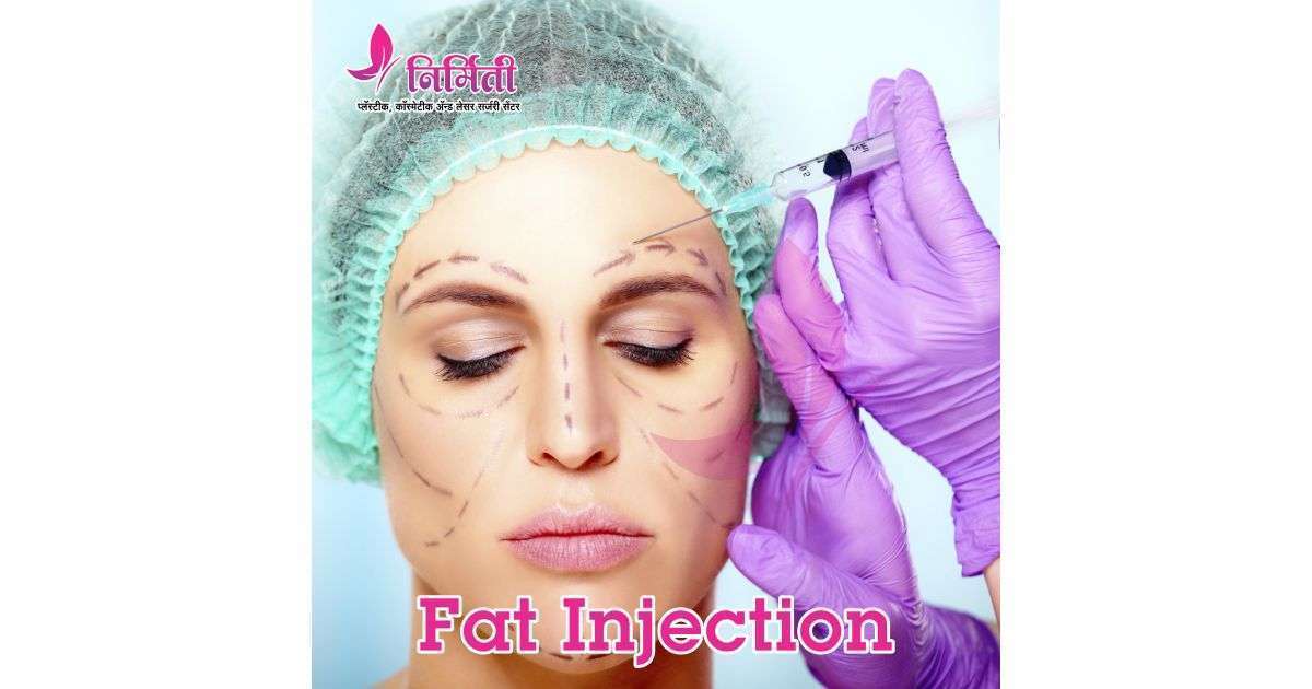 fat-injection-social