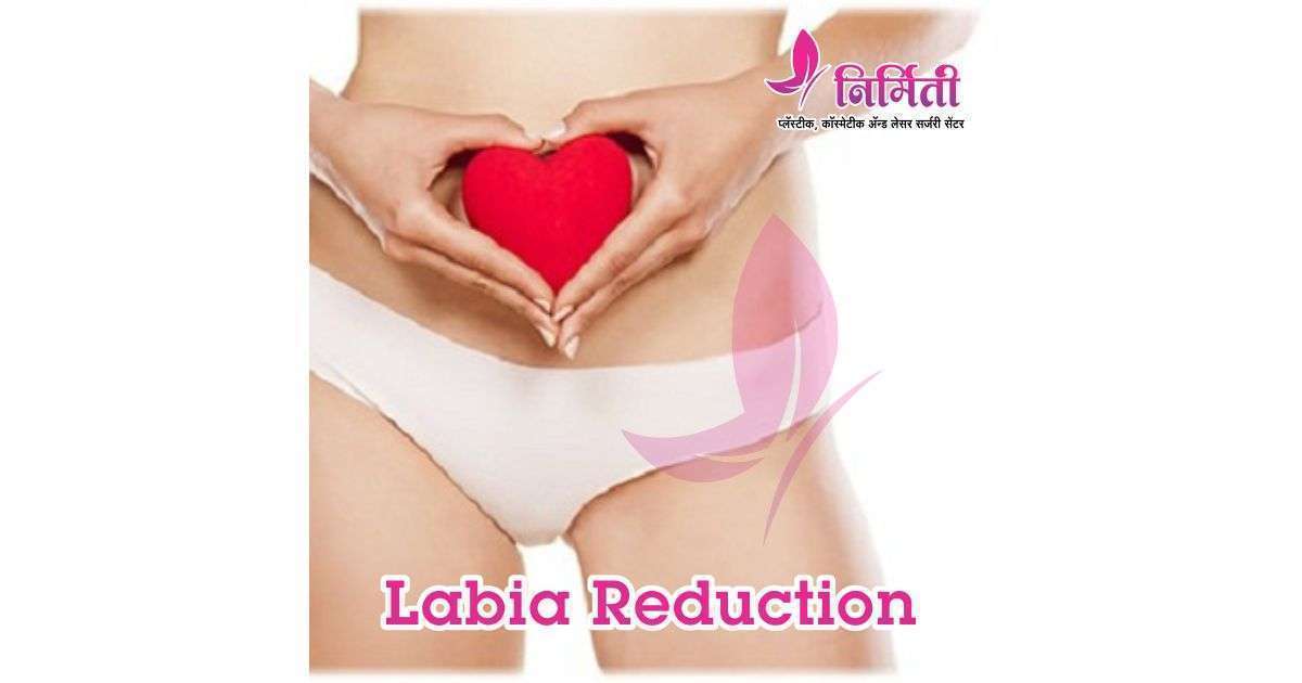 labia-reduction-social
