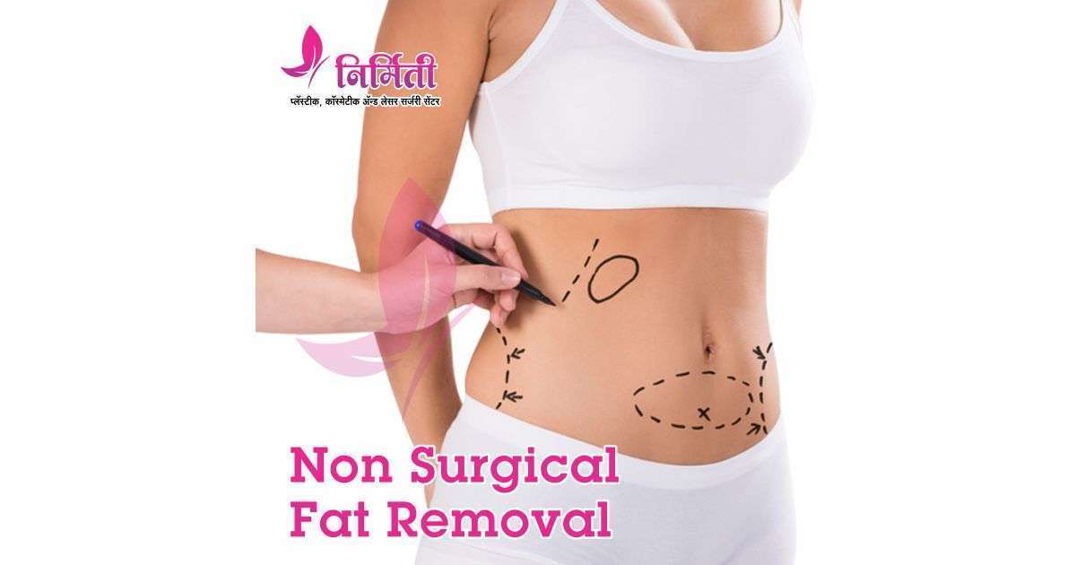 non-surgical-fat-removal-social