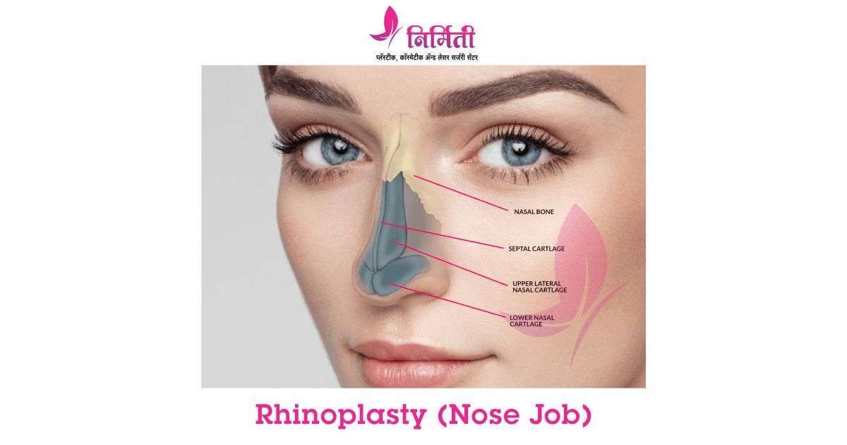rhinoplasty-(nose-job)-social
