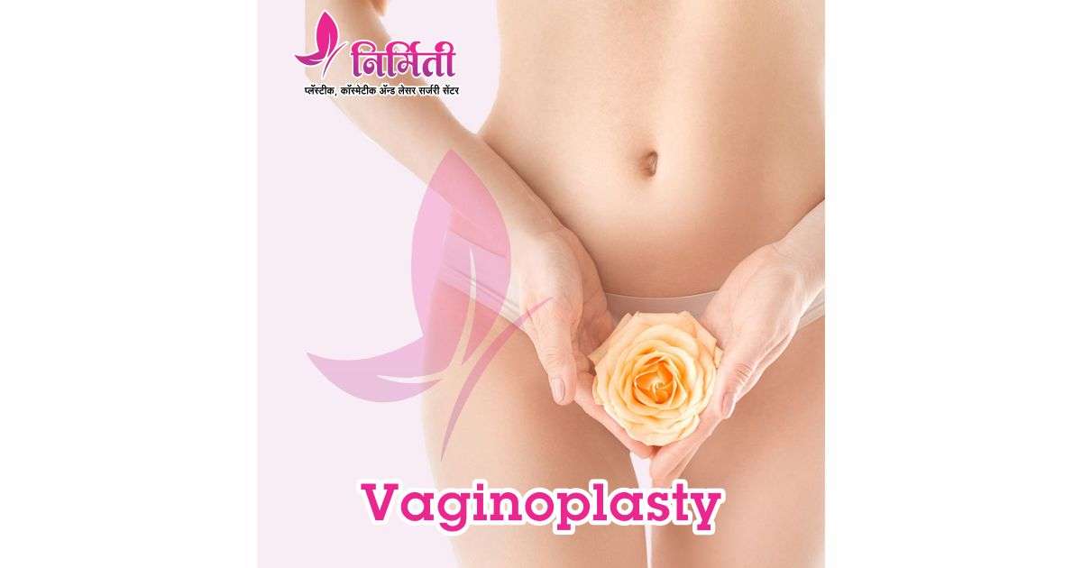 vaginoplasty-social