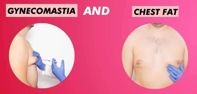 GYNECOMASTIA AND CHEST FAT Difference