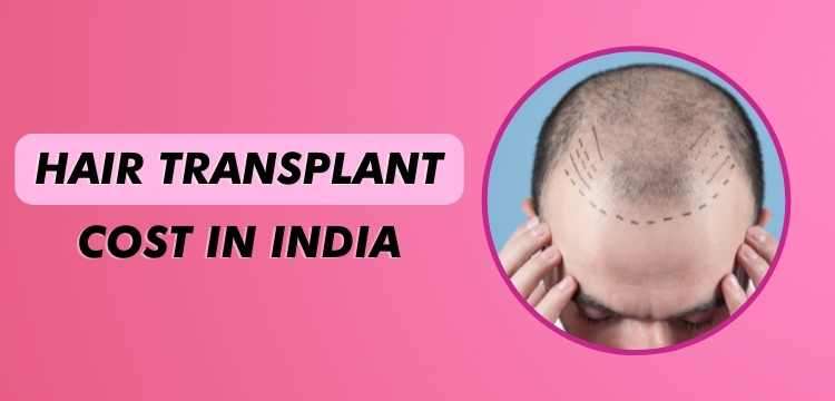 Hair Transplant Cost in India