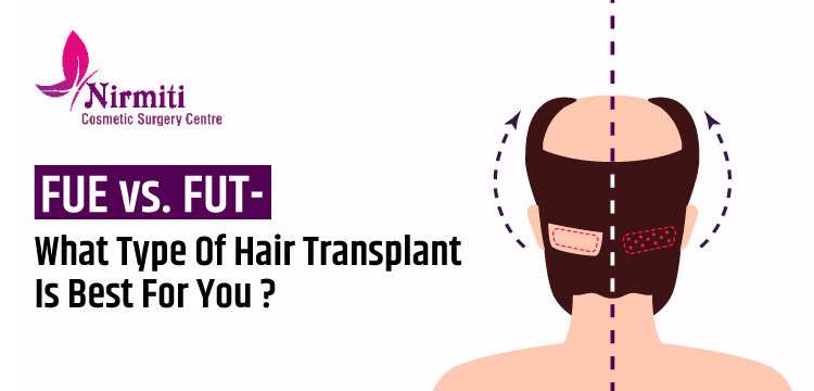 What Type of Hair Transplant Is Best?