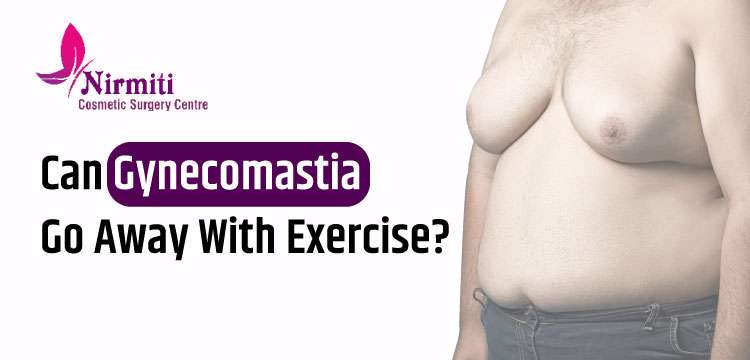 Can Gynecomastia Go Away With Exercise?