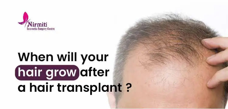 hair grow after hair transplant