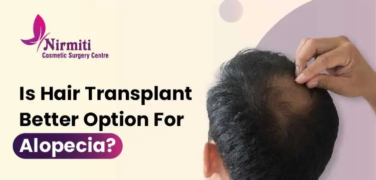 Hair Transplant Better Option For Alopecia | Dr. Neeraj Bhaban