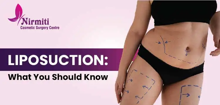 Liposuction