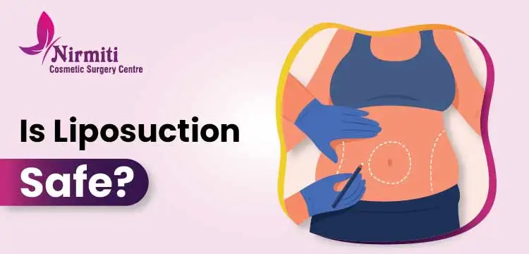 Is Liposuction Safe?