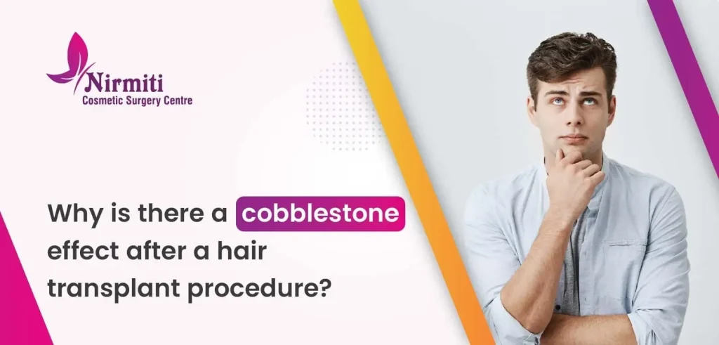 Cobblestone Effect After A Hair Transplant