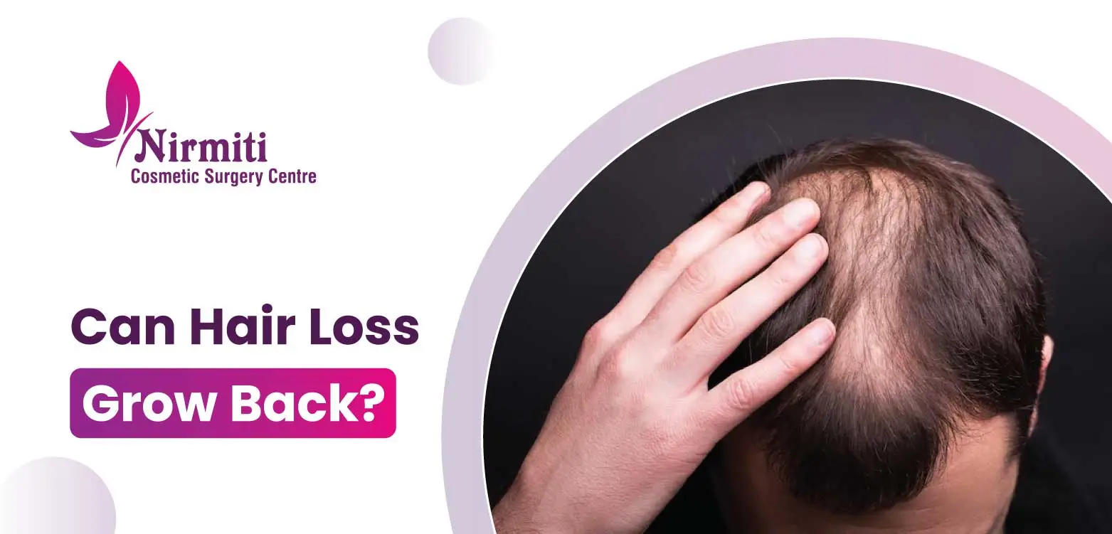 Can hair loss grow back