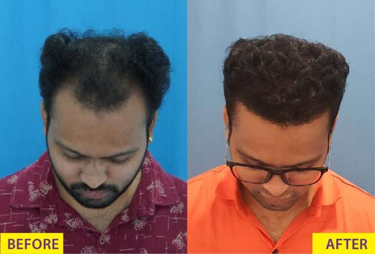 Hair treatment results