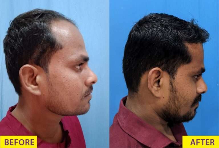 before and after hair treatment