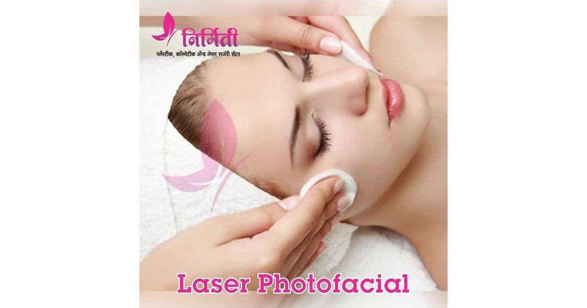 Laser Photofacial