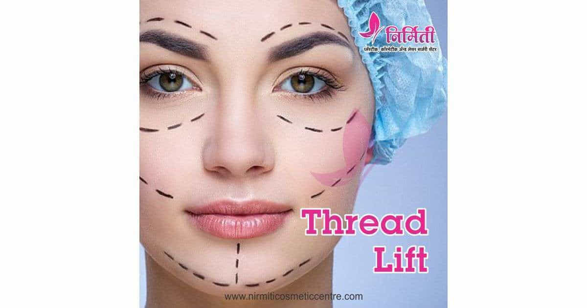 Thread lift treatment