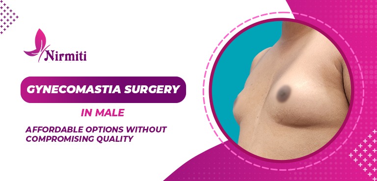 Gynecomastia Surgery in Men