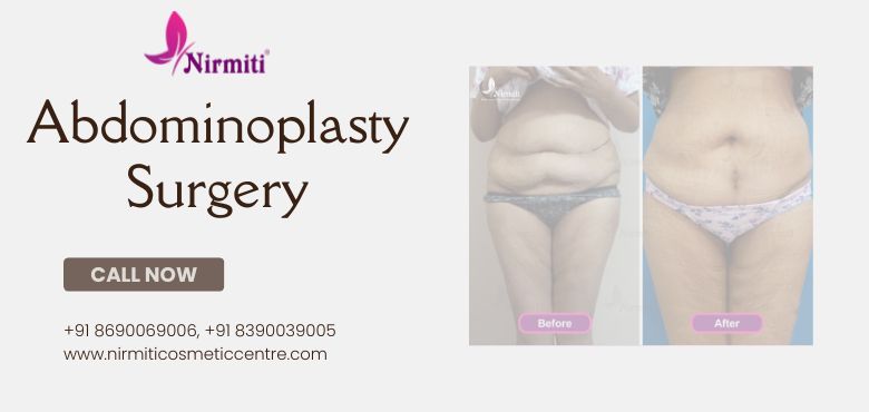 Abdominoplasty Surgery