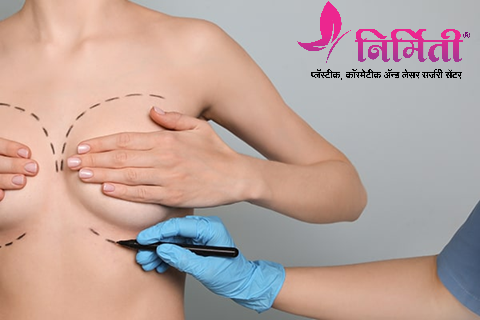Breast Augmentation Surgeon