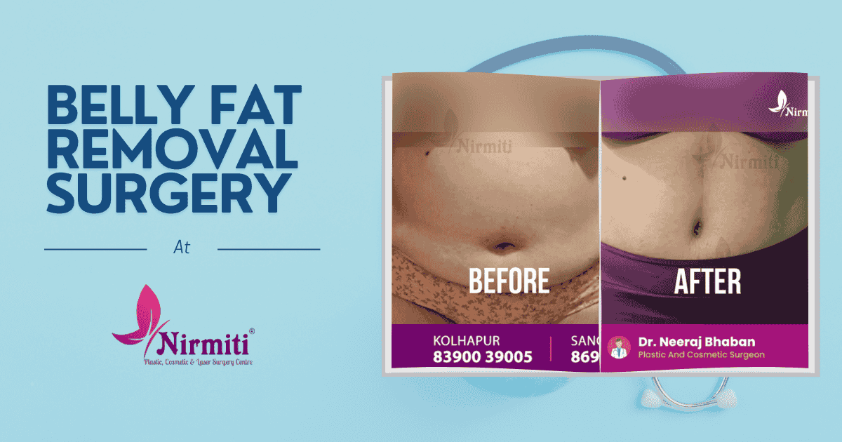 Belly Fat Removal Surgery