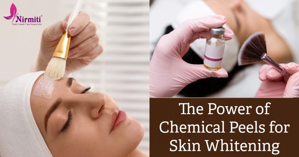 Chemical Peel For Skin Whitening