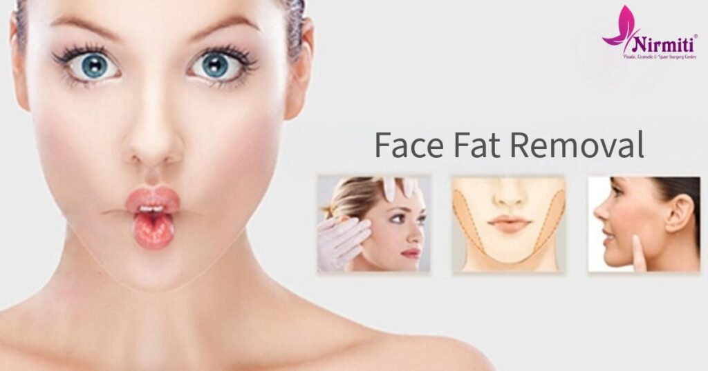 Face Fat Removal